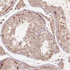 Anti-CENPF Antibody