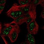 Anti-ATXN7L3 Antibody