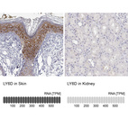 Anti-LY6D Antibody