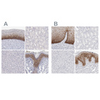 Anti-LY6D Antibody