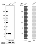 Anti-LY6D Antibody