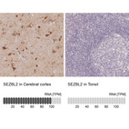 Anti-SEZ6L2 Antibody