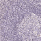 Anti-SEZ6L2 Antibody