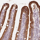 Anti-TMSB15B Antibody