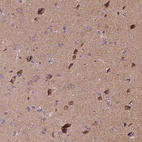 Anti-SNCAIP Antibody