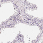 Anti-GYG2 Antibody