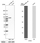 Anti-GYG2 Antibody