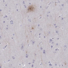 Anti-PCSK1N Antibody