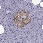 Anti-PCSK1N Antibody