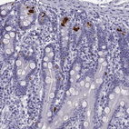 Anti-PCSK1N Antibody