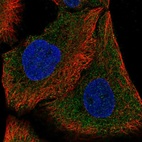 Anti-DAAM1 Antibody