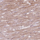 Anti-KCNK15 Antibody