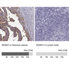 Anti-SEMG1 Antibody