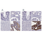 Immunohistochemical staining of human colon, kidney, liver and seminal vesicle using Anti-SEMG1 antibody HPA064892 (A) shows similar protein distribution across tissues to independent antibody HPA042476 (B).