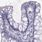 Immunohistochemical staining of human colon using Anti-SEMG1 antibody HPA064892.