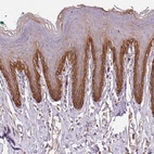 Anti-TMEM253 Antibody