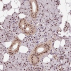 Anti-RAD23A Antibody