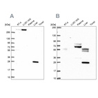 Anti-QDPR Antibody