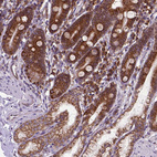 Anti-WDR83OS Antibody