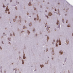 Anti-WDR83OS Antibody