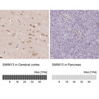 Anti-SMIM13 Antibody