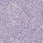 Anti-SMIM13 Antibody