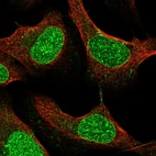 Anti-SMIM13 Antibody