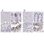 Anti-HIST1H1T Antibody