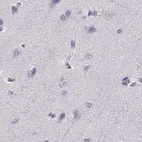 Immunohistochemical staining of human cerebral cortex using Anti-HIST1H1T antibody HPA065718.