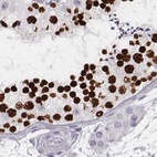 Immunohistochemical staining of human testis using Anti-HIST1H1T antibody HPA065718.