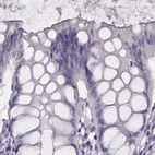 Immunohistochemical staining of human colon using Anti-HIST1H1T antibody HPA065718.