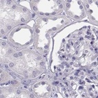 Immunohistochemical staining of human kidney using Anti-HIST1H1T antibody HPA065718.