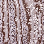 Anti-NSMCE2 Antibody