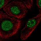 Anti-C1orf174 Antibody