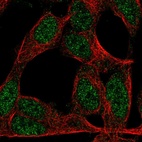 Anti-ZNF423 Antibody