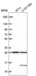 Anti-TBC1D16 Antibody