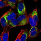 Anti-TBC1D16 Antibody