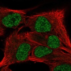 Anti-SCML4 Antibody