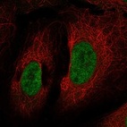 Anti-CHD9 Antibody