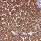 Anti-SC5D Antibody