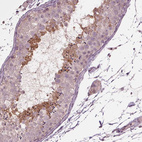 Anti-CXCL16 Antibody