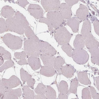 Anti-CXCL16 Antibody