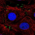 Anti-MTSS1L Antibody