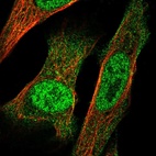 Anti-IRX3 Antibody