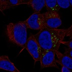 Anti-ST8SIA3 Antibody