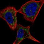 Anti-PLXNC1 Antibody