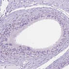 Anti-TMEM210 Antibody