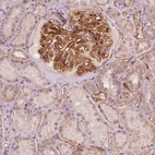 Anti-TSPO2 Antibody