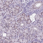 Anti-APCDD1L Antibody