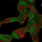 Anti-BTF3L4 Antibody